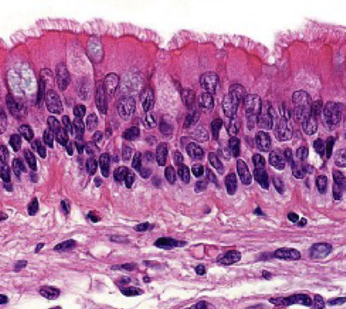 <p>classify the epithelium</p>