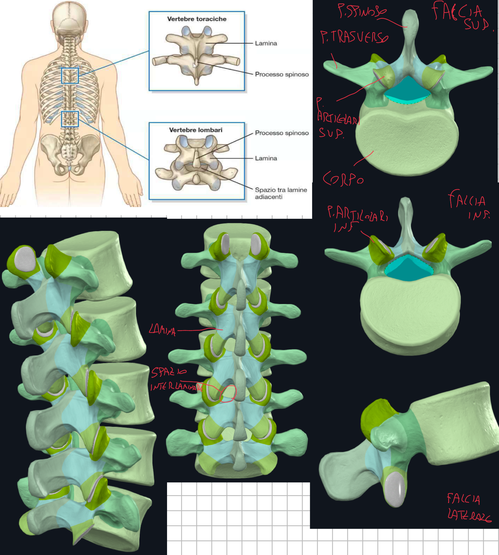<p>Caratteristiche:</p><ul><li><p>Corpi Vertebrali  voluminosi e robusti, di forma reniforme → come abbiamo detto, man mano che si scende con la colonna, i corpi sono sempre più robusti, siccome il carico meccanico da sopportare è sempre maggiore.</p></li><li><p>Foro Vertebrale → forma triangolare, con un ampiezza minore di quello cervicale, ma più grande di quello toracico (tutto ciò è dovuto ai rigonfiamenti del midollo spinale)</p></li><li><p>Processo Spinoso → corto, orientato orizzontalmente e con forma ad ascia</p></li><li><p>Processi Trasversi → lunghi e sottili → alla loro base posteriore presentano il Processo Accessorio</p></li><li><p>Processi Articolari → i superiori guardano medialmente, gli inferiori lateralmente → hanno orientamento sagittale per favorire flessione ed estensione, mentre è limitata la rotazione → sulla faccia posteriore di quelli superiori troviamo il processo mammillare</p></li><li><p>Spazio Interlaminare → le lamine non si sovrappongono, anzi ci sono spazi ampi → questo è importante perché questo spazio viene sfruttato per accedere al canale vertebrale per praticare punture lombali (prelievo del liquor)</p></li></ul><p></p>
