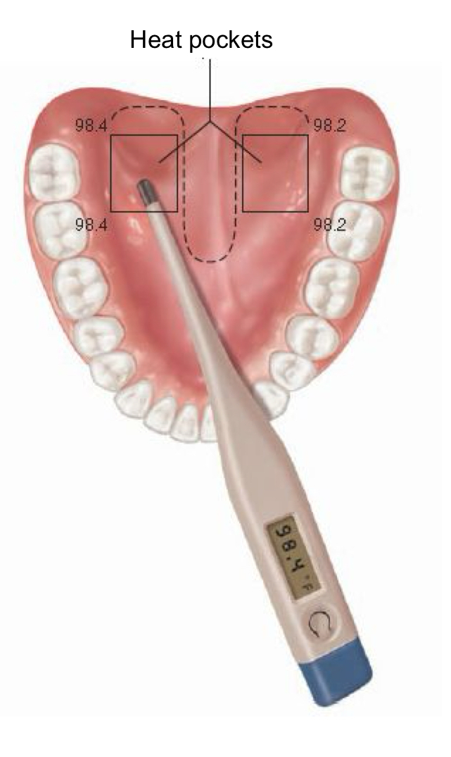 <ul><li><p>electronic or digital</p></li><li><p>normal is 98.6</p></li><li><p>place under tongue in one pocket just of-center in lower jaw</p></li><li><p>insure patient does not talk</p></li><li><p>wait at least 15 minutes after eating, drinking, or smoking</p></li></ul><p></p>