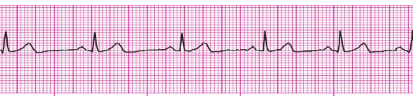 <p>What’s the rhythm?</p>