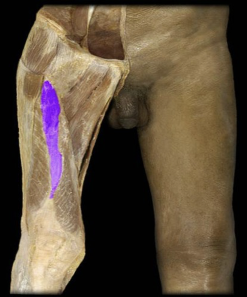 <p><em>Quadriceps muscle, lies beneath rectus femoris, table 5,7</em></p>