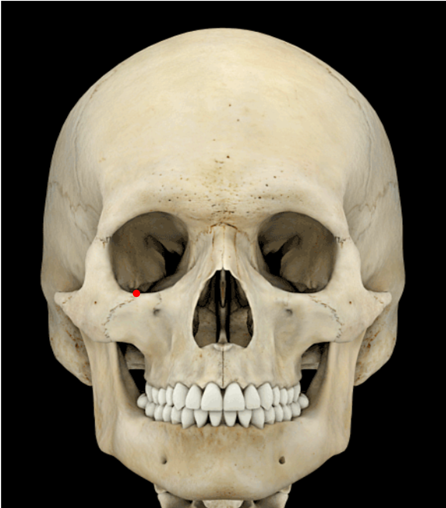 <p>Lowest point on orbital margin</p>