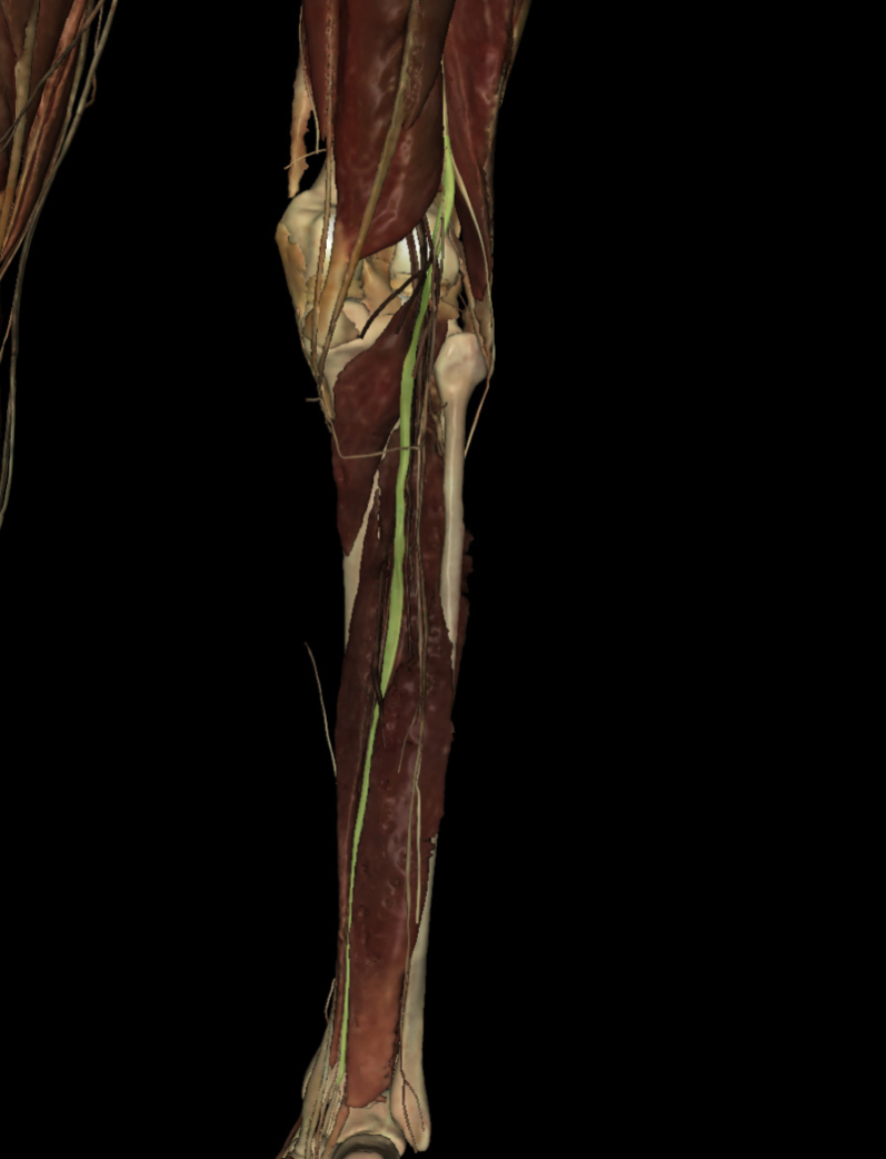 <p>Identify the Structure</p>