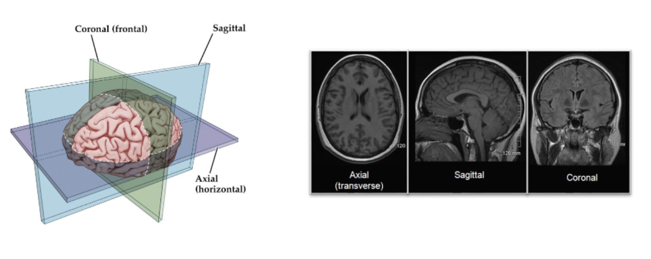 <p>caudal/frontal = front to back/anterior to posterior</p><p>sagittal/longitudinal = left to right/lateral-medial-lateral</p><p>axial/horizontal/transverse = top to bottom/dorsal-ventral</p>