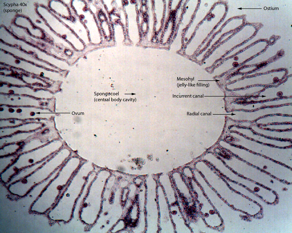 <p>gelatinous matrix with scattered cells</p>