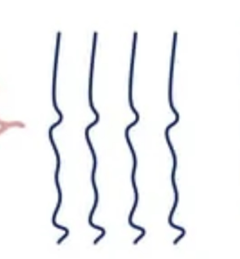 <p>Branching fibers </p>