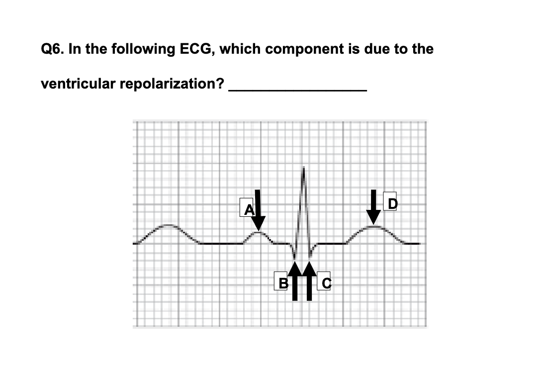 <p>what component is due to ventricular repolarization? </p>