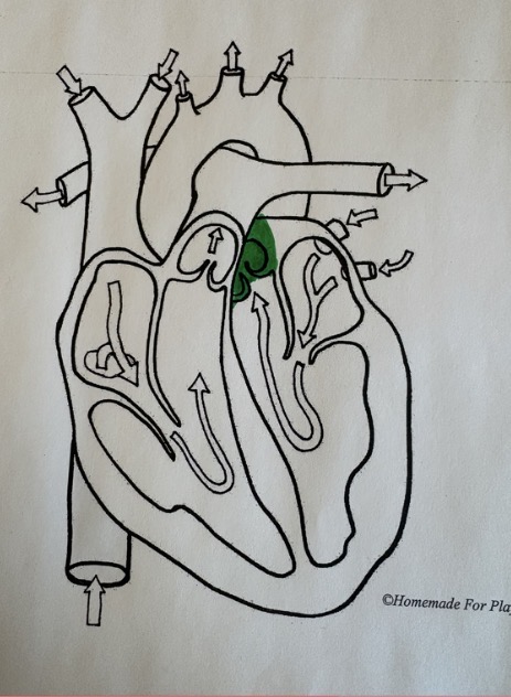 <ul><li><p>Between the left ventricle and aorta</p></li></ul><p></p>