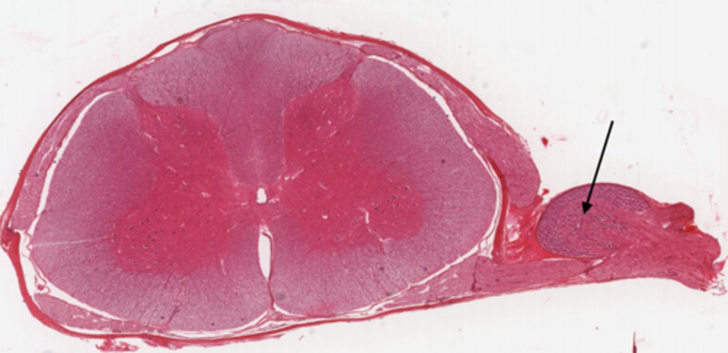 <p>Identify the part of the spinal cord</p>