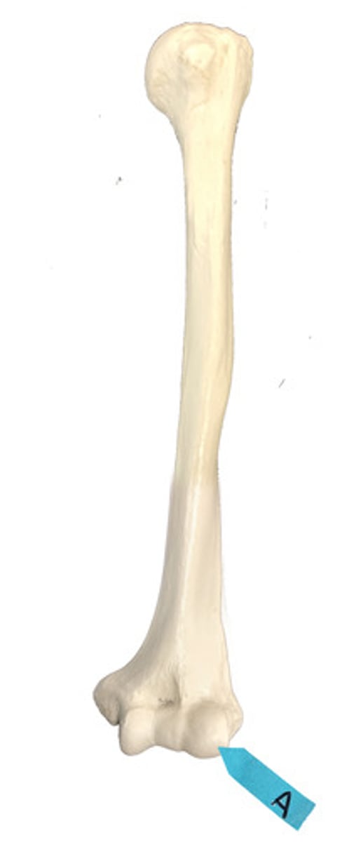 <p>Identify this bone marking.</p>