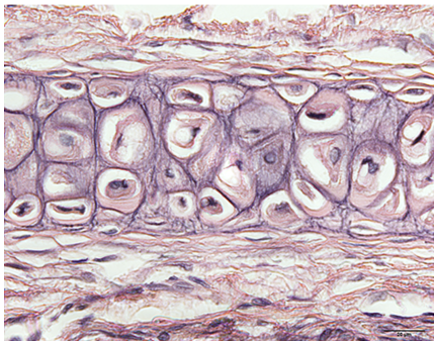<p>What cartilage is this?</p>