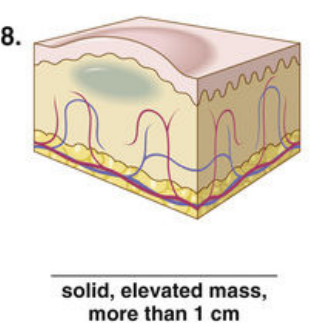 <p><span style="color: red">F Match each of the following lesions with their illustrations in Figure 16-26.</span></p><p></p>