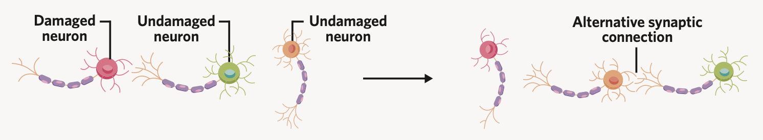 a neuron’s ability to form a new connection with another undamaged neuron

* allows for cognitive functioning to be re-developed