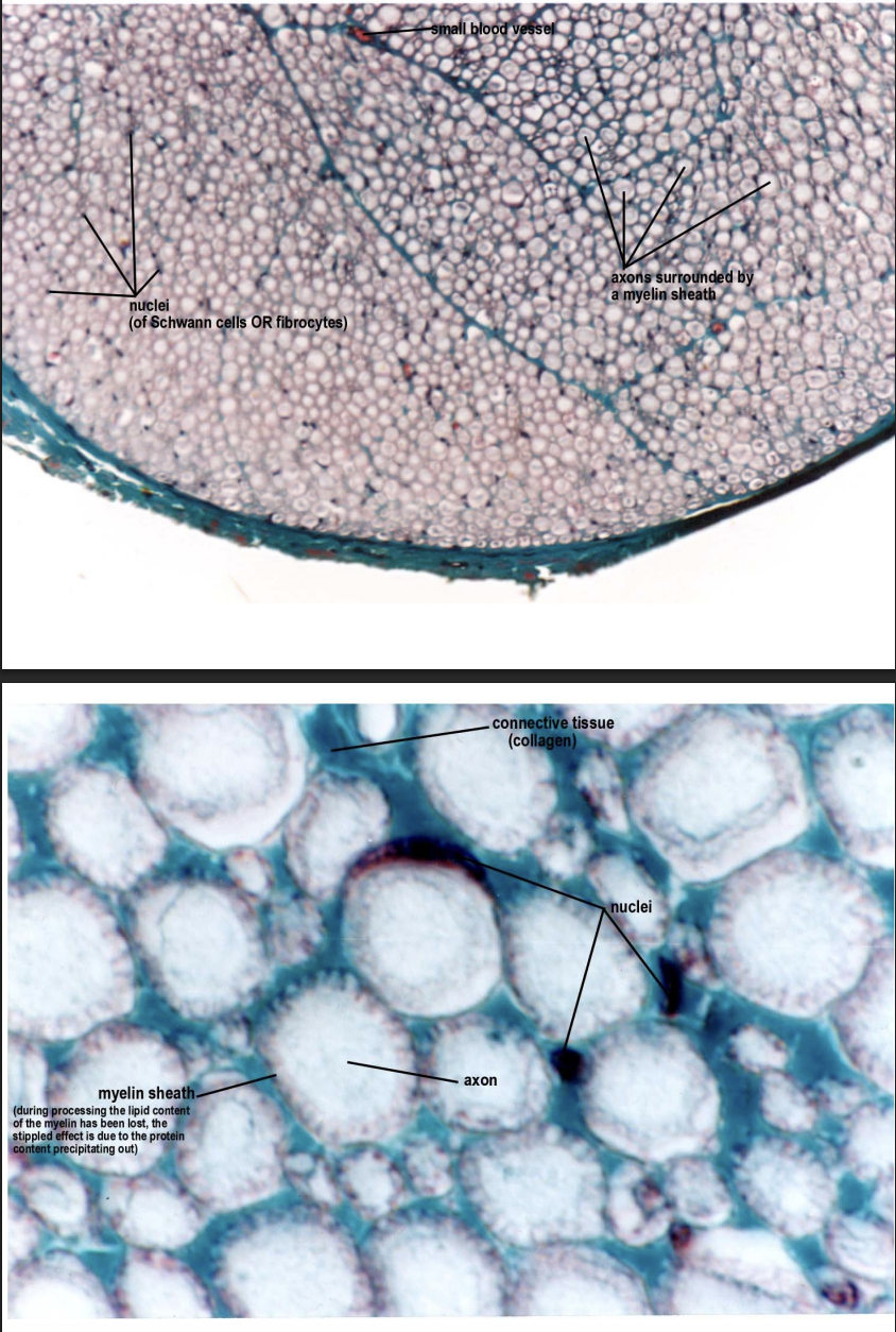 <p>Function of nerve cells</p><ul><li><p>receiving, generating and transmitting nerve impulses</p></li></ul><p></p><p>Different types but will see</p><ul><li><p>ganglia and nerve trunks</p></li></ul><p>Support cells</p><ul><li><p>different types</p></li><li><p>Schwann cells give rise to myelin</p></li></ul><p></p>