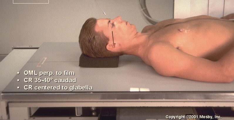<p>What position is this?</p>