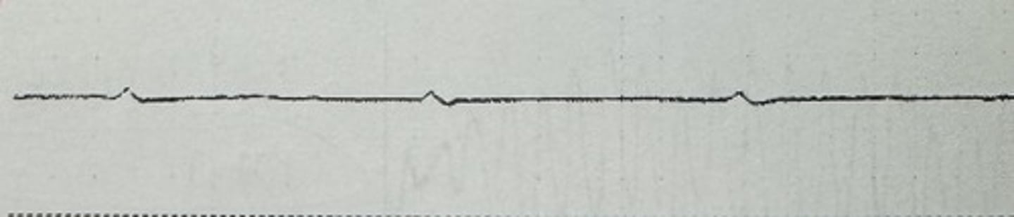 <p>identify the rhythm</p>
