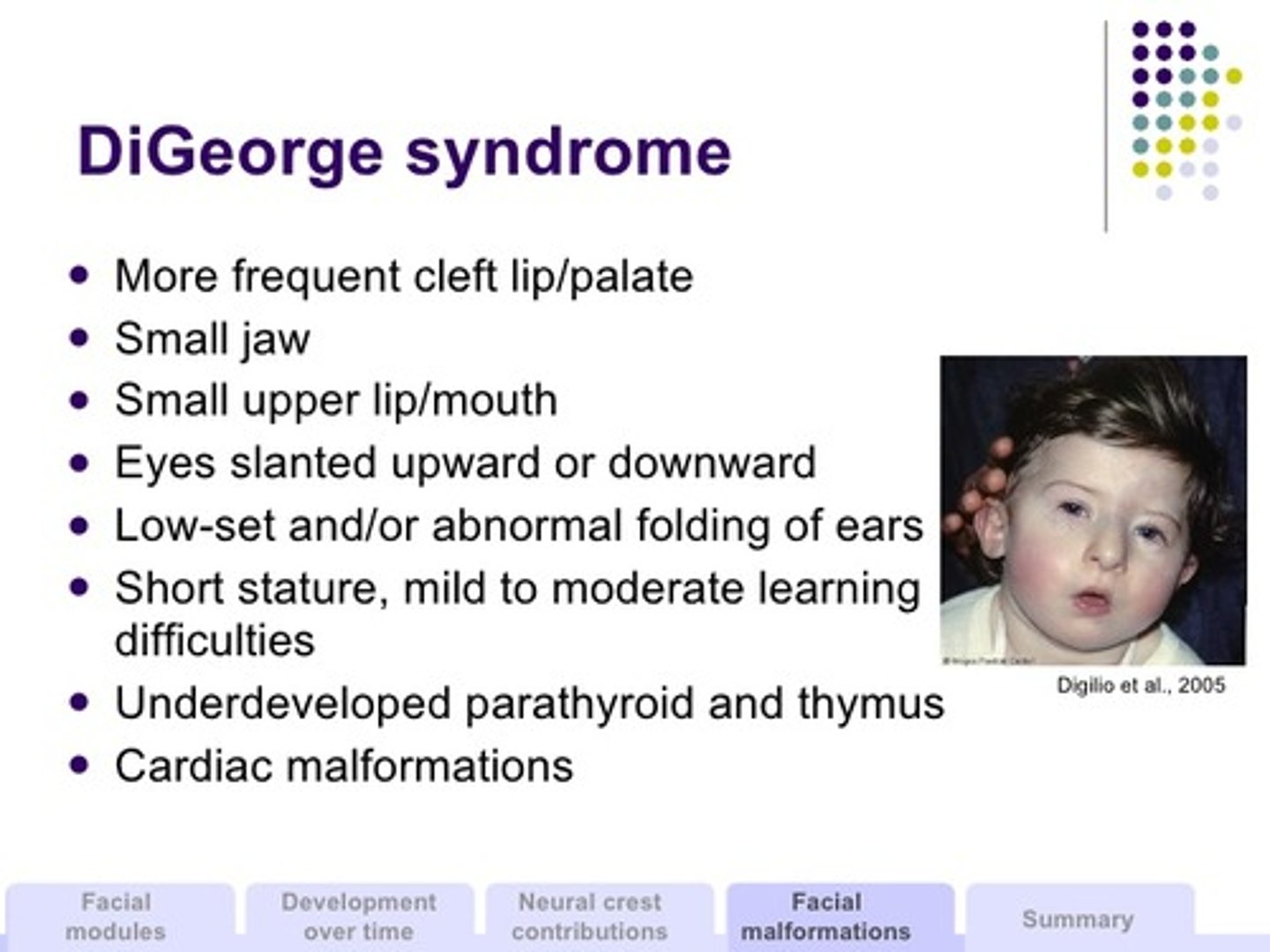 <p>congenital heart disease, abnormal faces (cleft lip) hypocalcemia, tetany</p>