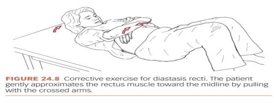 <ul><li><p>head lift</p><ul><li><p>pt is in hooklying position and crosses arms around the stomach area for support</p></li><li><p>have pt exhale and lift only the head off the floor, while at the same time, using their hands to gently approximate the rectus muscles toward midline</p></li><li><p>then lower the head slowly and relax </p></li></ul></li></ul><p></p>
