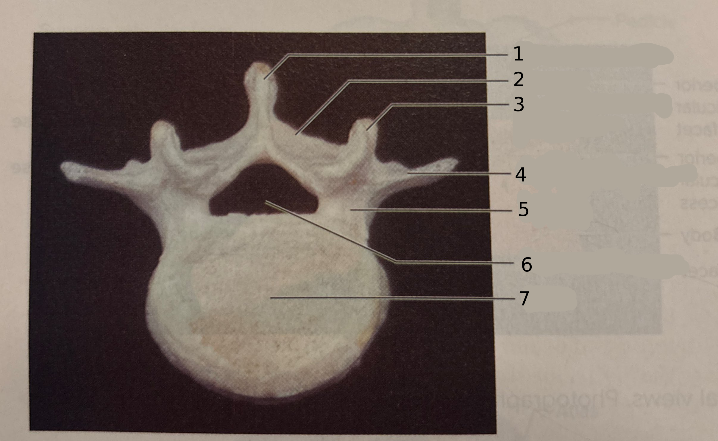 <p>#5</p>