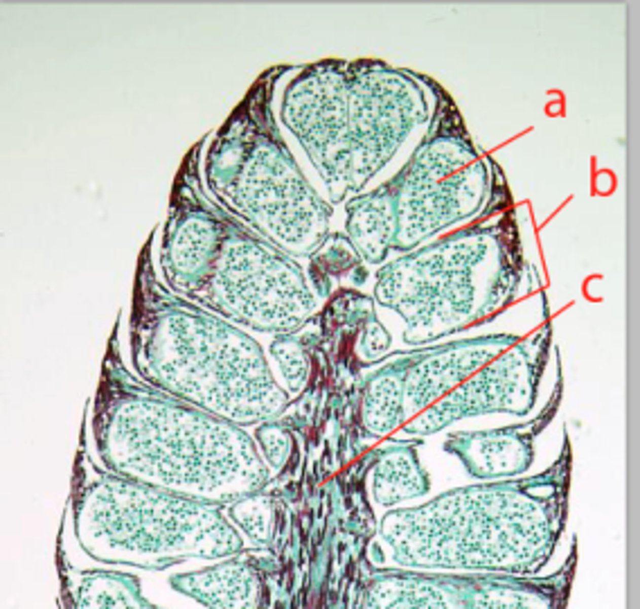 <p>structure b</p>