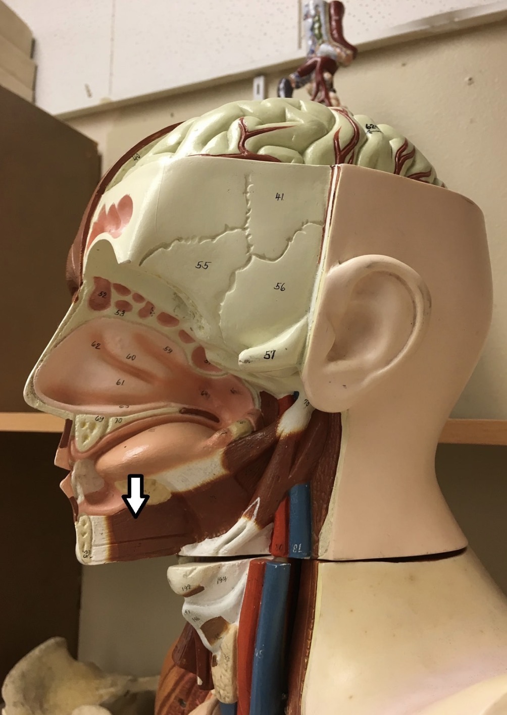 <p><span>Name the muscle labeled with the white arrow below AND name ONE action .</span></p>