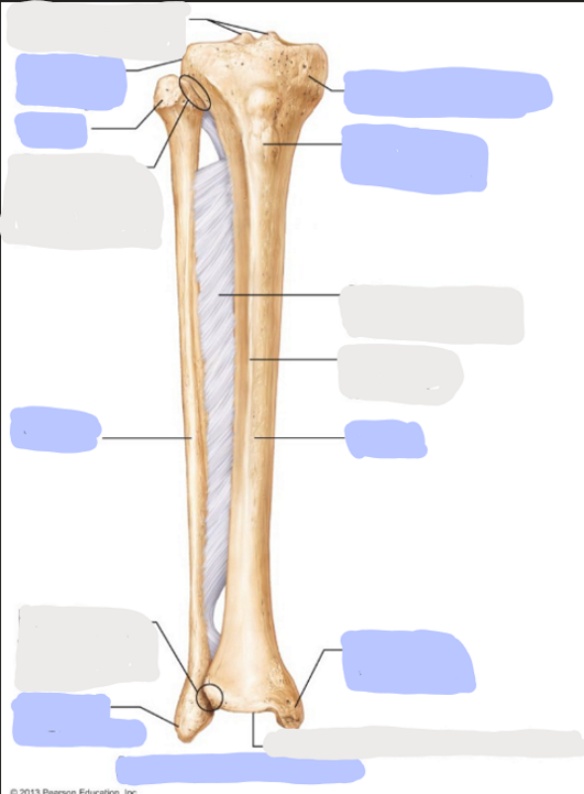 <p>Where is the <strong>Head </strong>of the Fibula?</p>