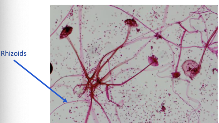<p>Rhizopus oryzae</p>