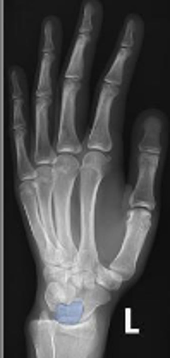 <p>What is outlined?</p>