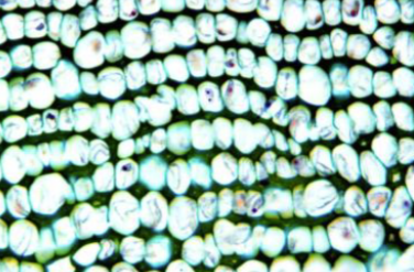 <p>No intercellular space, compactly arranged, found in petiole of leaves</p>