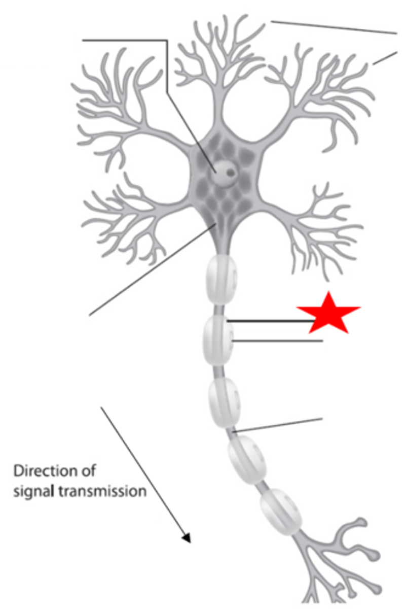 <p>'schwann cell'</p>