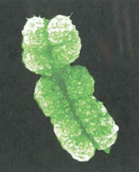 <p>Replicated condensed chromosome with sister chromatids</p>