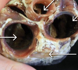 <p>bottom arrow&nbsp;</p>