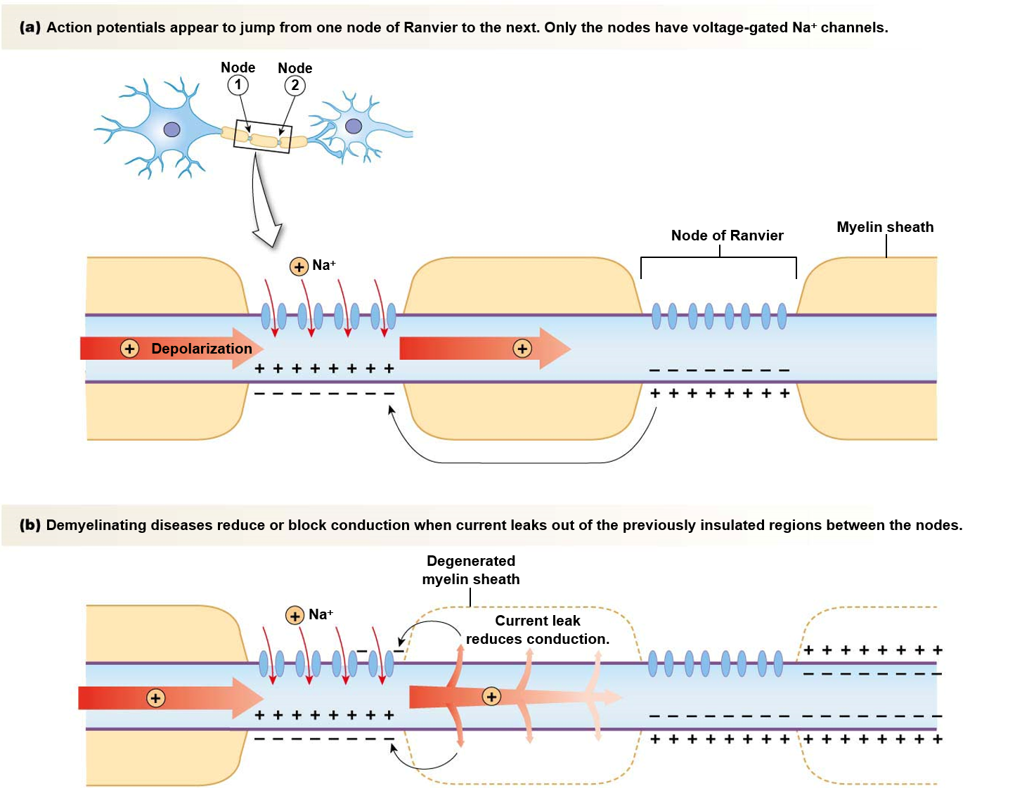 <p><u>speed of action potential influenced by</u>:</p><ul><li><p>diameter of axon (<strong>larger </strong>= faster)</p></li><li><p>resistance of axon membrane to ion leakage (<strong>myelinated </strong>= faster)</p><ul><li><p>only Nodes of Ranvier have channels - action potentials “jump” between nodes.</p></li><li><p><strong>saltatory conduction</strong></p></li></ul></li></ul>