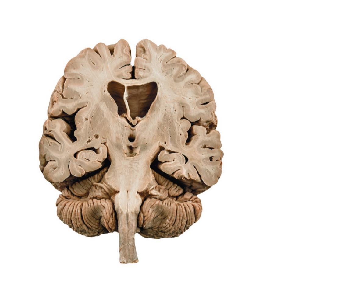 <p>identify color matters of the brain</p>