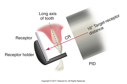 <ul><li><p><strong>Maxillary arch:</strong> Increase the positive vertical angulation. Imagine the PID (position indicating device) as if it's pointing slightly downwards towards the floor.<span>&nbsp;</span></p></li><li><p><strong>Mandibular arch:</strong> Increase the negative vertical angulation. The PID would be angled slightly upwards.<span>&nbsp;</span></p></li></ul><p></p>