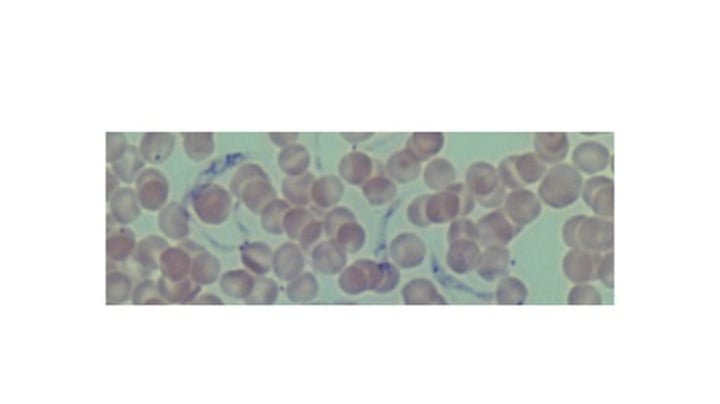 <p>What phylum does Trypanosoma lewisi belong to?</p>