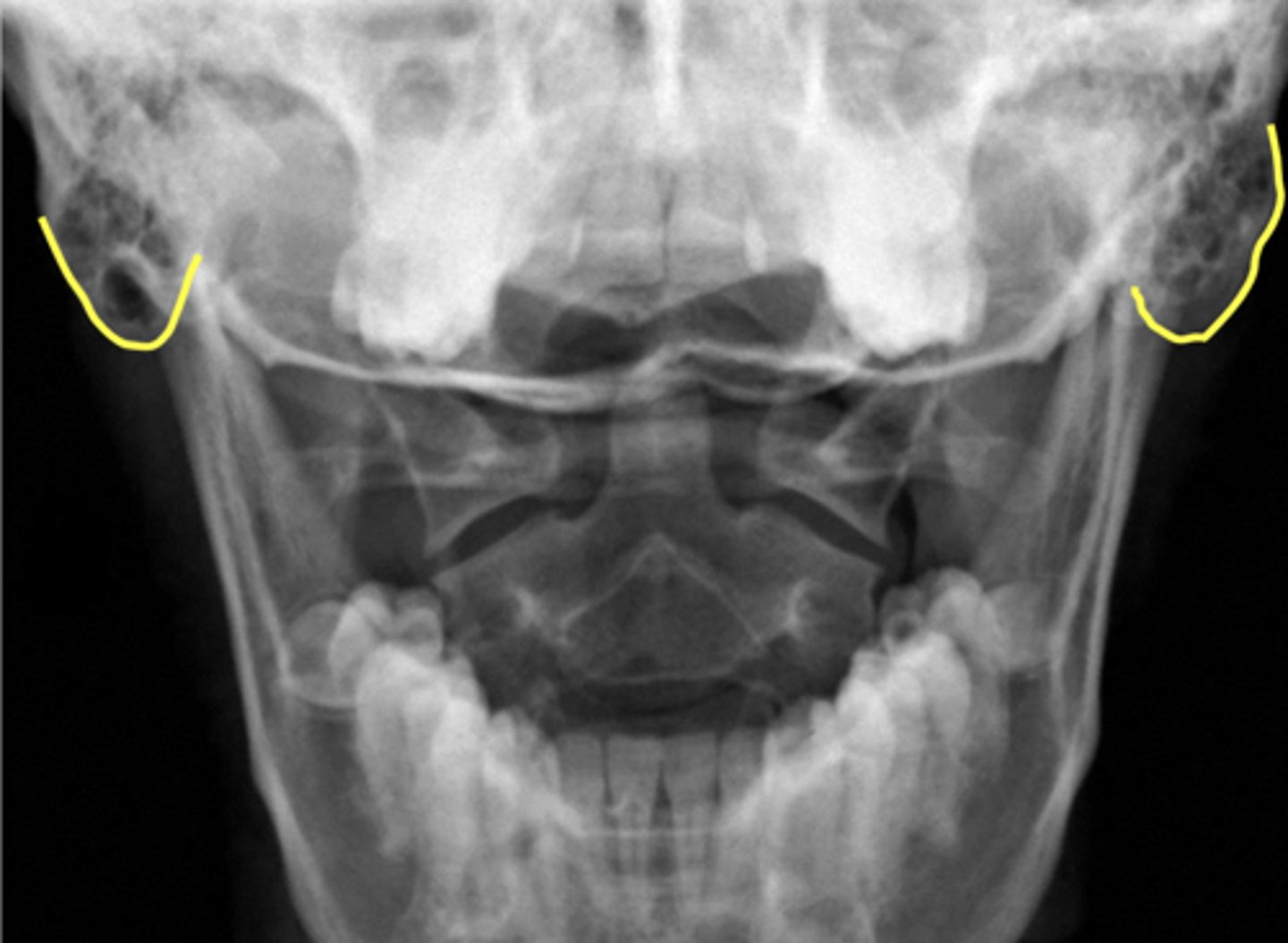 <p>What are outlined in yellow?</p>