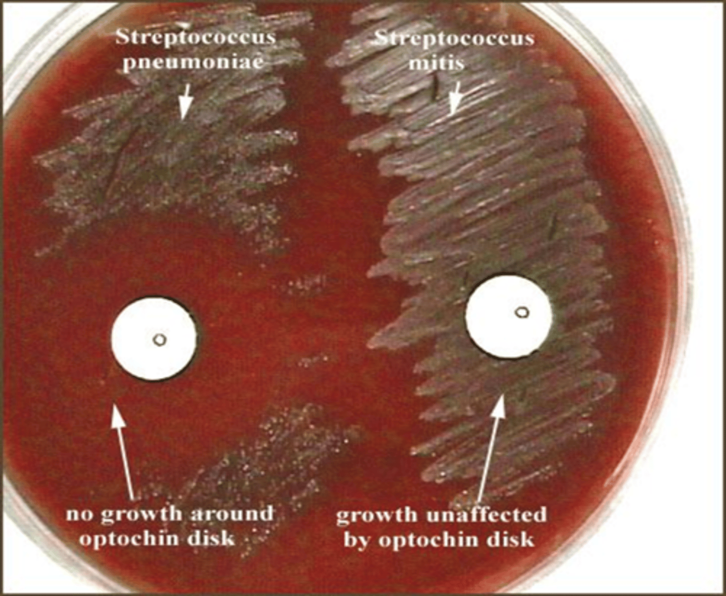 <p>Test that determines whether or not a bacteria is resistant to antibiotics. An antibiotic disk is placed, and if there's a clearing around the disk, the bacteria is more sensitive to the antibiotic and is therefore not resistant.</p>
