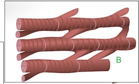<p>yes, its striated (has stripes)</p>