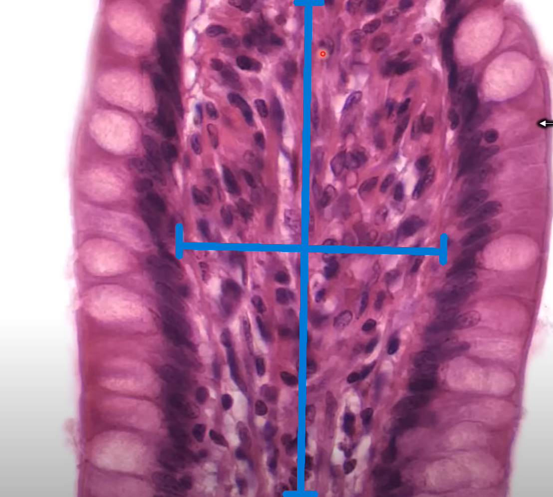 <p>Finger-like structure?</p><p>Commonly found where?</p><p>Inner region represented by blue?</p><p>Clear cup looking cells that are on the outside border?</p>