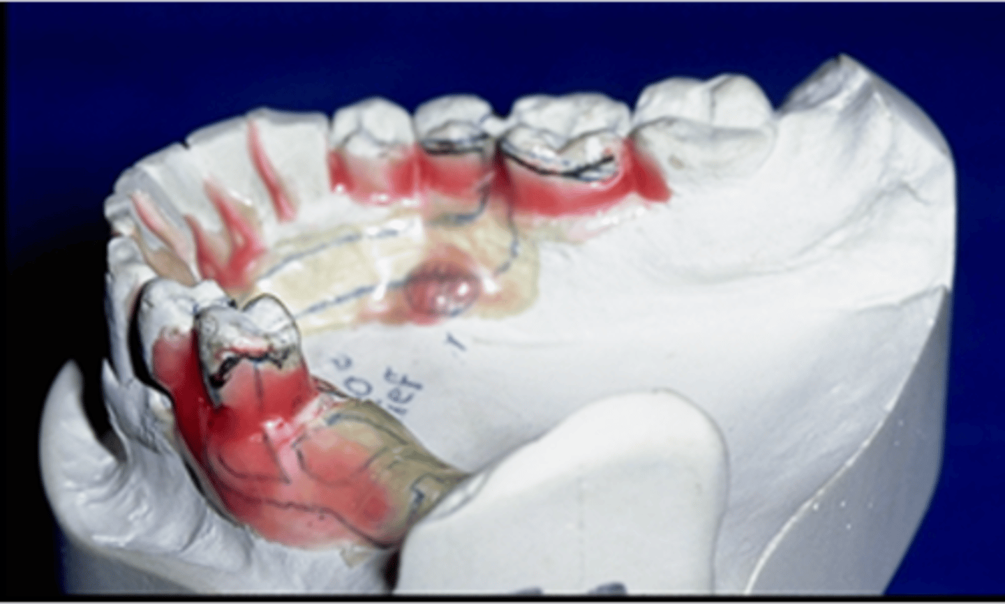 <p>wax block out (relief)</p>