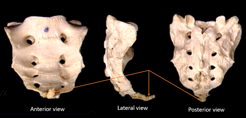 name the bone 