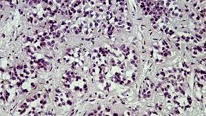 Pinealocytes