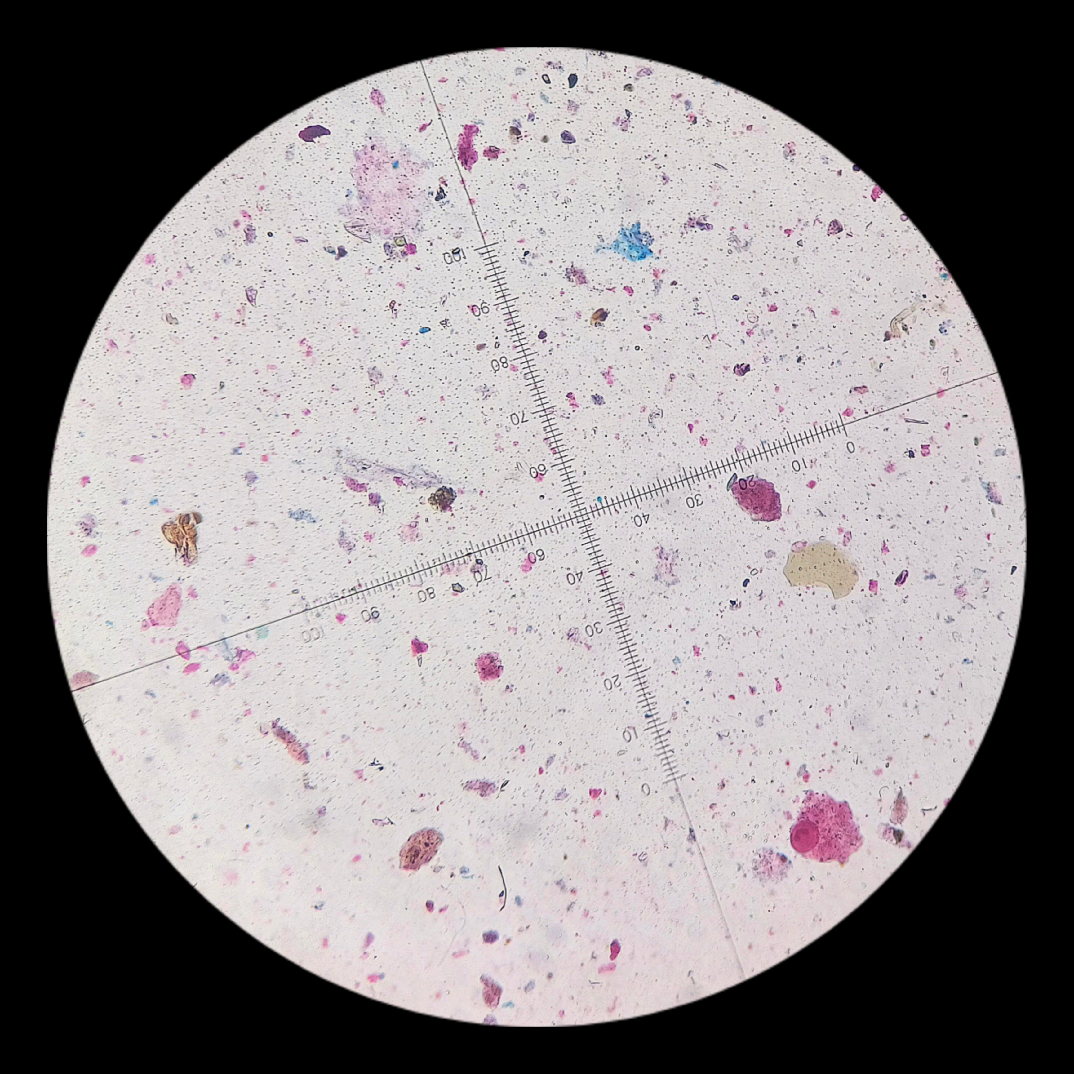 <p>Phylum of <em>Balantidium coli</em></p>