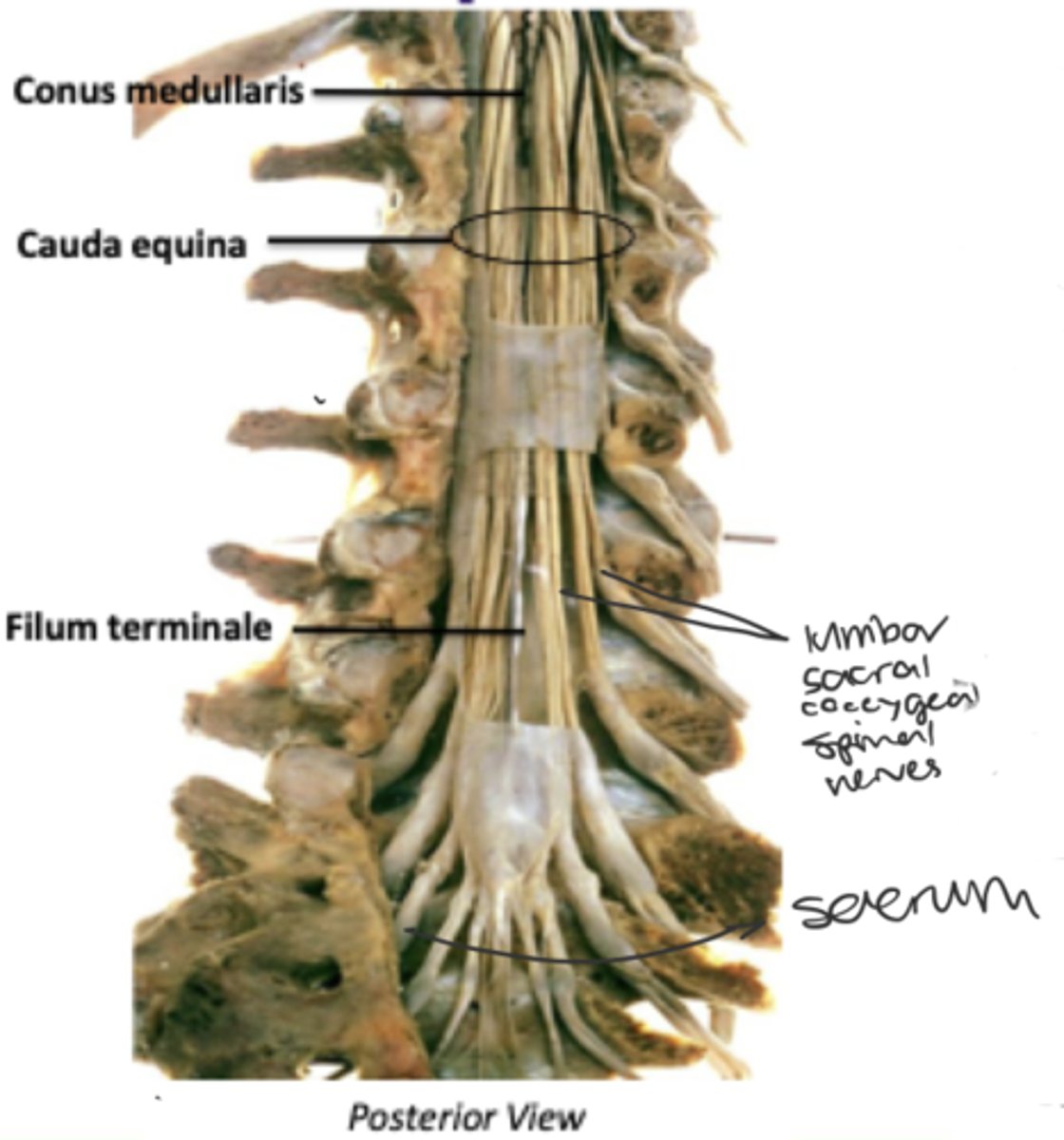 <p>Cauda equina</p><p>Conus medullaris</p><p>Filum terminale</p><p>Dentate ligament</p>