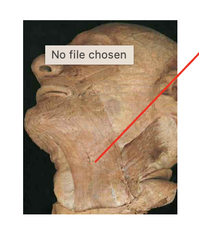 <p>What is this muscle: What is its origin and insertion</p>