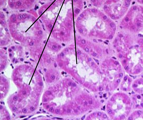 <p>what is this histology representing?</p>
