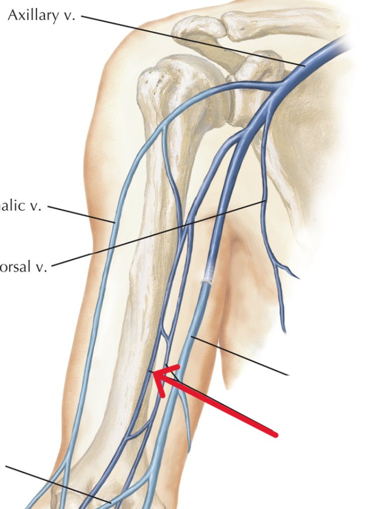 <p>Which veins:</p><ul><li><p>Extend distally from axillary vein</p></li><li><p>Runs down the arm</p></li><li><p>Medial to cephalic vein, lateral to basilic vein</p></li></ul><p></p>