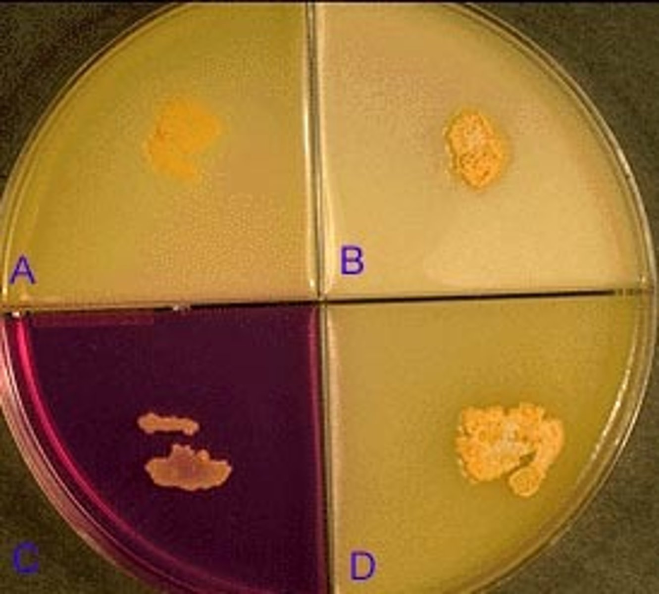 <p>Illustrated in this photograph is an agar quadrant plate containing casein (A), tyrosine (B), nitrate (C) and xanthine (D). None of the substrates have been hydrolyzed and nitrate has been reduced. The most likely identification is:</p><p>A. Nocardia asteroides</p><p>B. Nocardia brasiliensis</p><p>C. Streptomyces griseus</p><p>D. Actinomadura madurae</p>