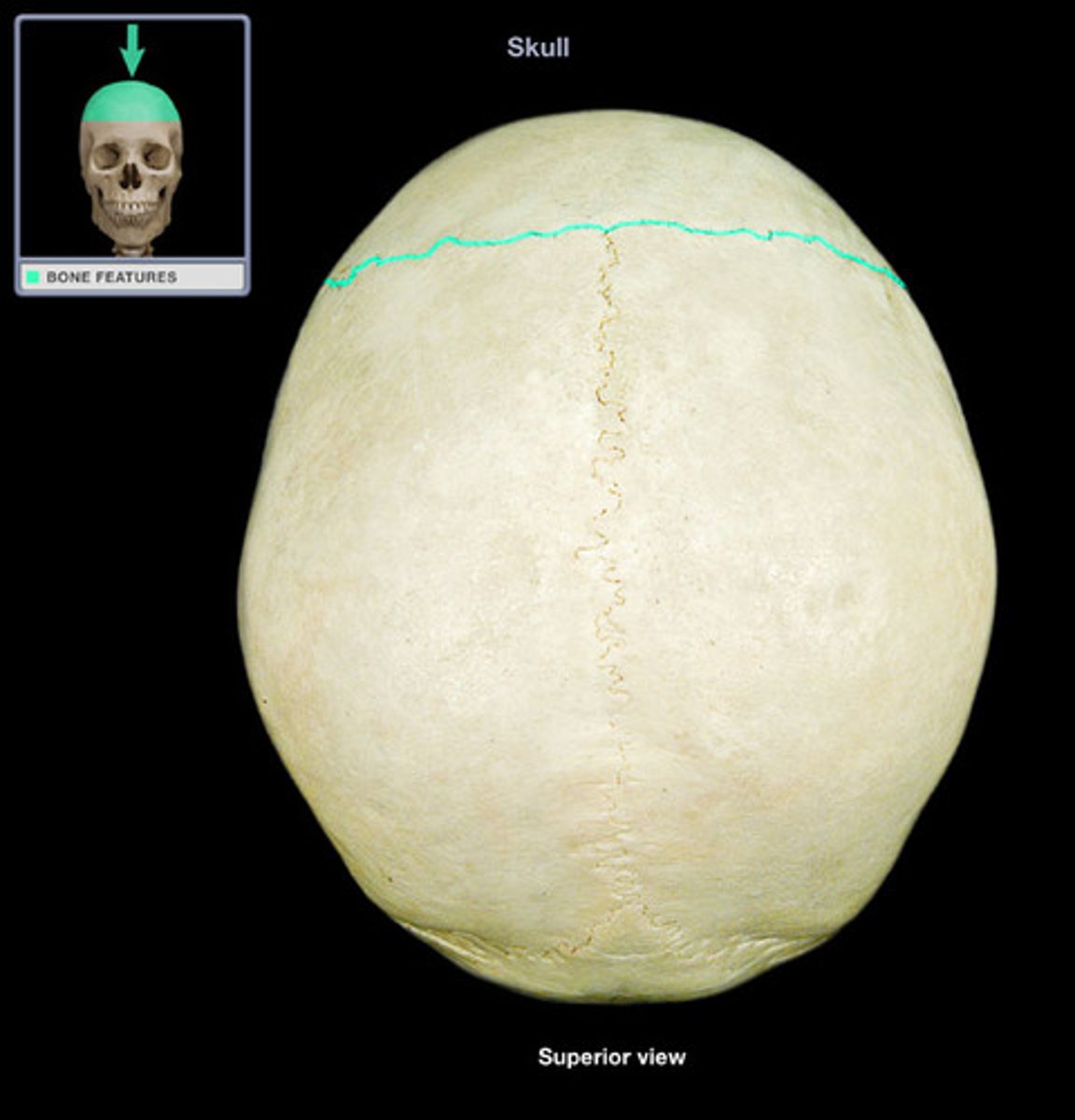 <p>(name the suture)</p>